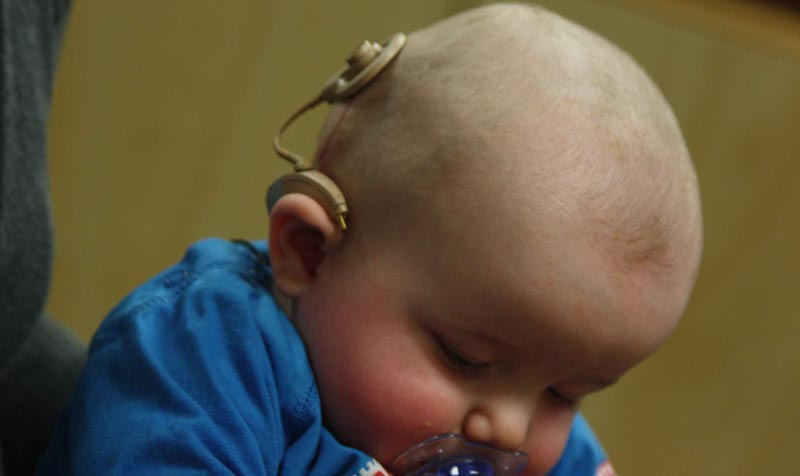 Bébé avec implant cochléaire. © Bjorn Knetsch.